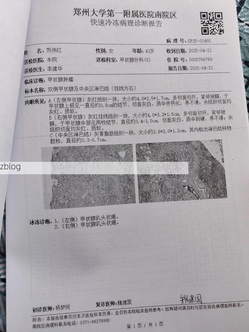 2022年4月6日贞丰新增确诊病例情况_13354