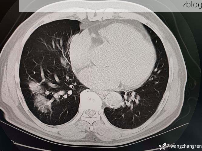 【平远：粤北山区屏障下的低感染样本观察】