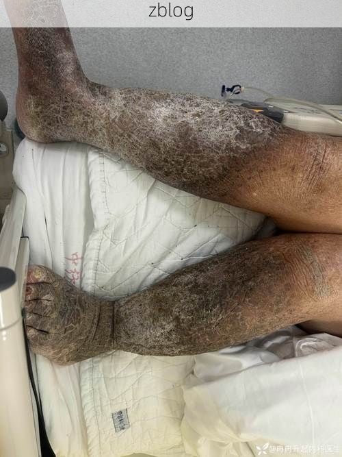 新宾：辽东林海屏障下的低感染样本