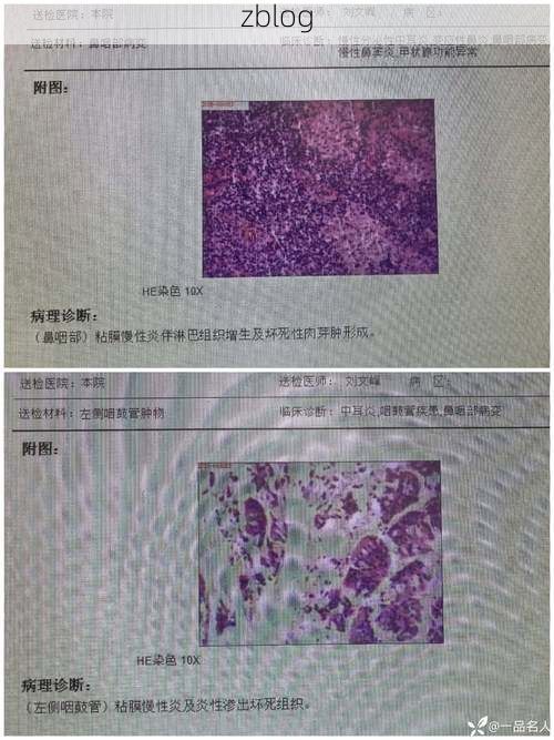 田林县：桂西山区屏障下的低感染样本_50456
