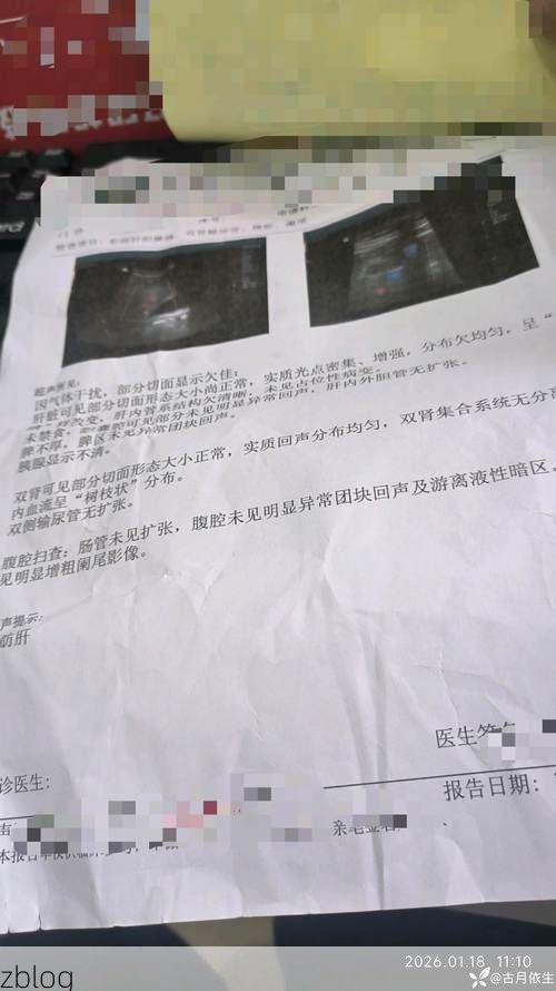 本地确诊+1，广昌通报新增病例情况_17788