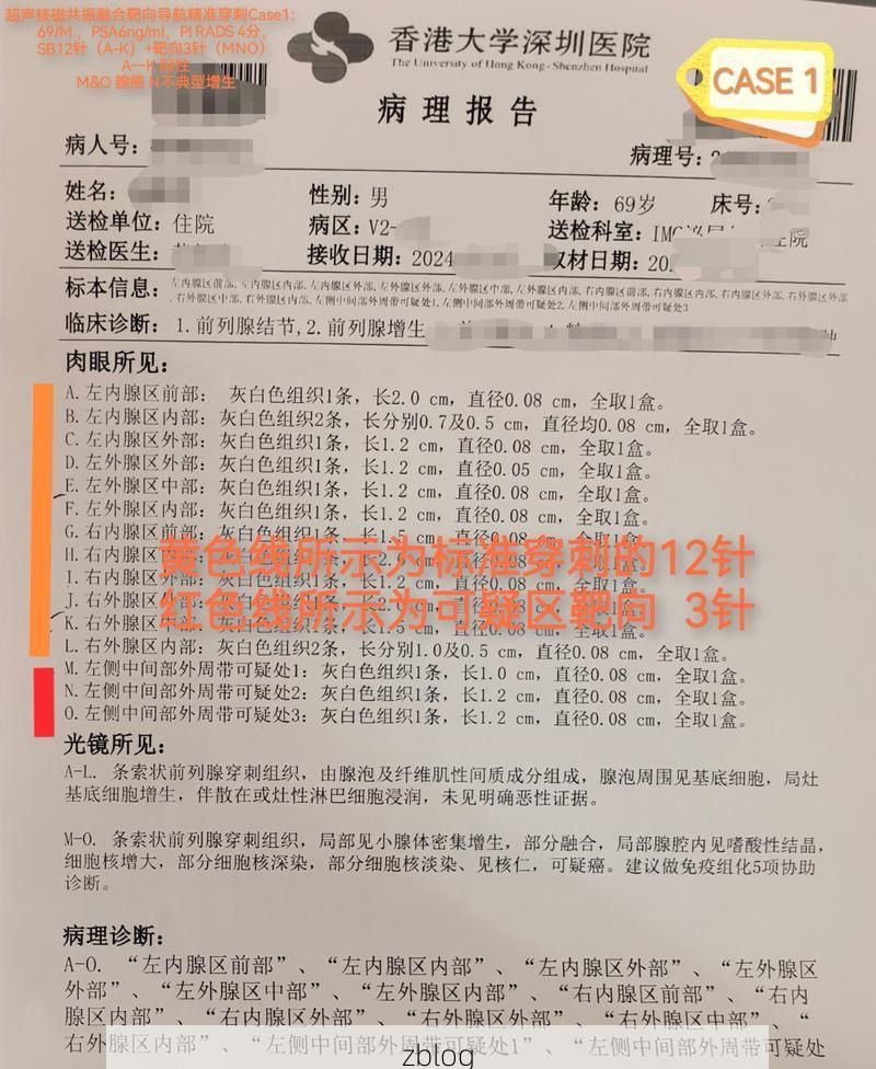 2022年8月15日昌都洛隆县新增确诊病例情况