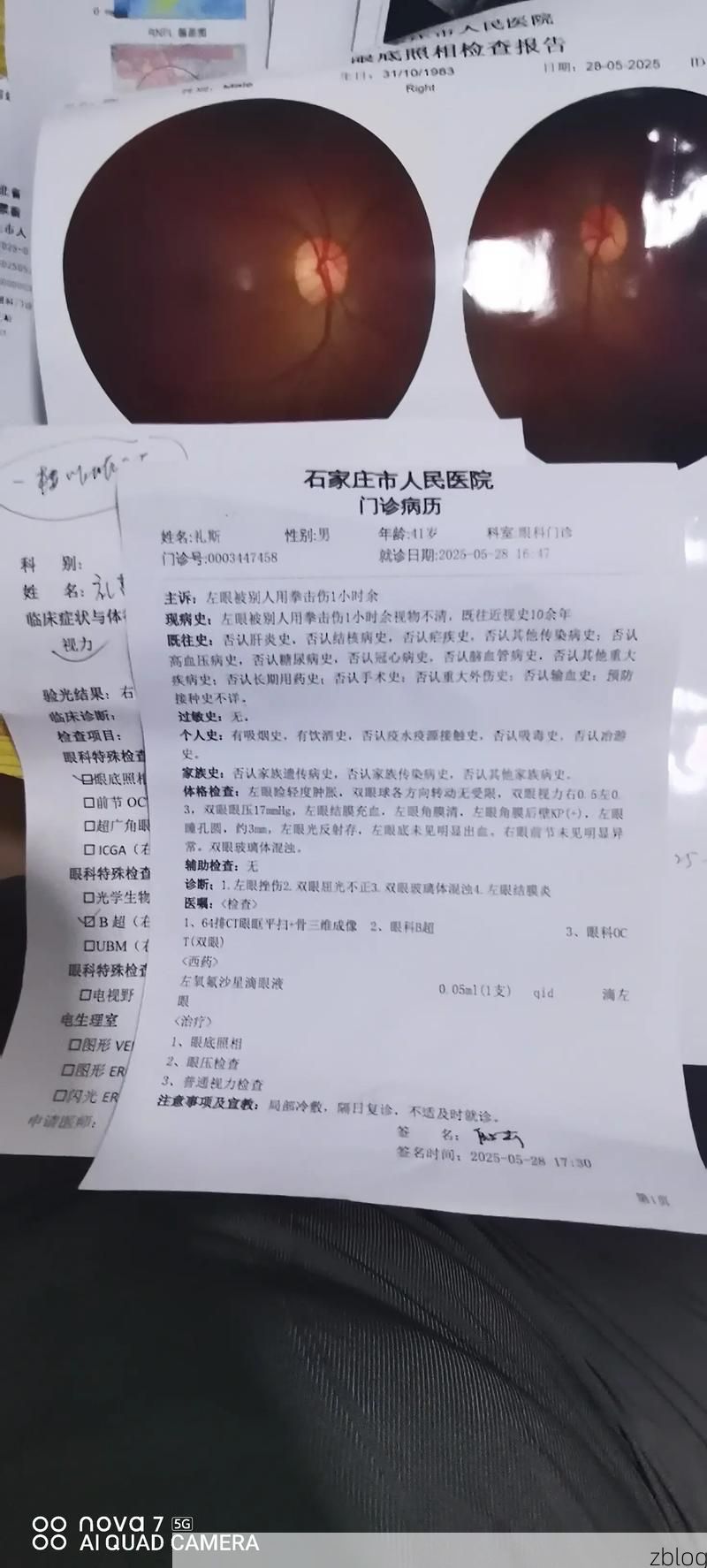 2022年3月15日金平区新增确诊病例情况_46106