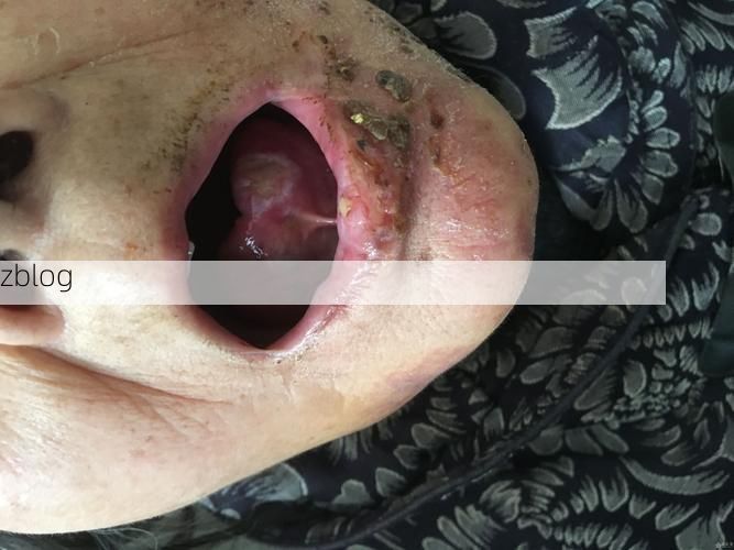 威信县：乌蒙山屏障下的低感染样本