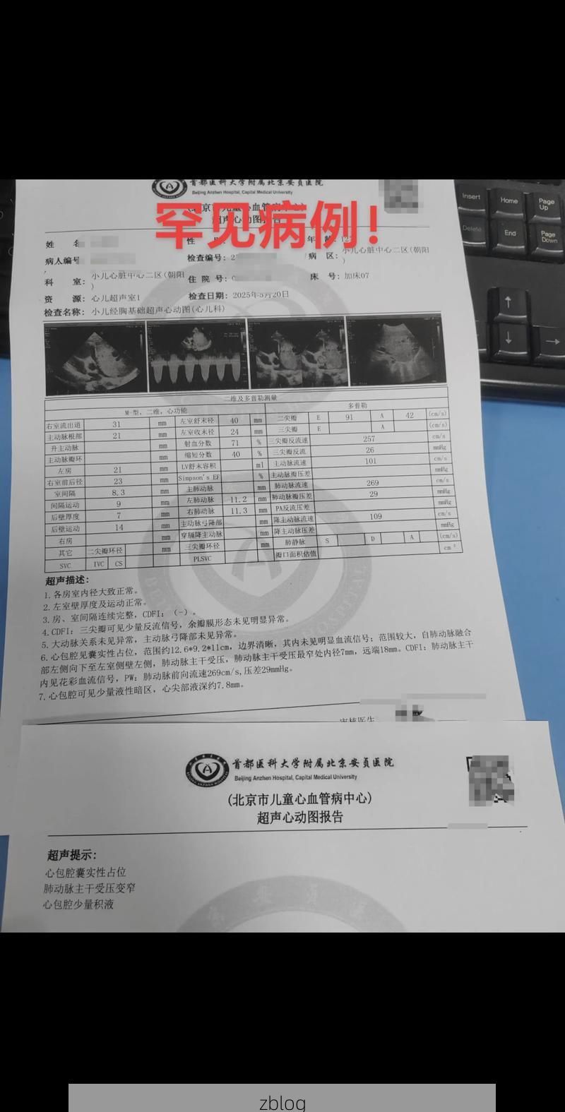 2022年11月25日阿克塞哈萨克族自治县新增确诊病例情况