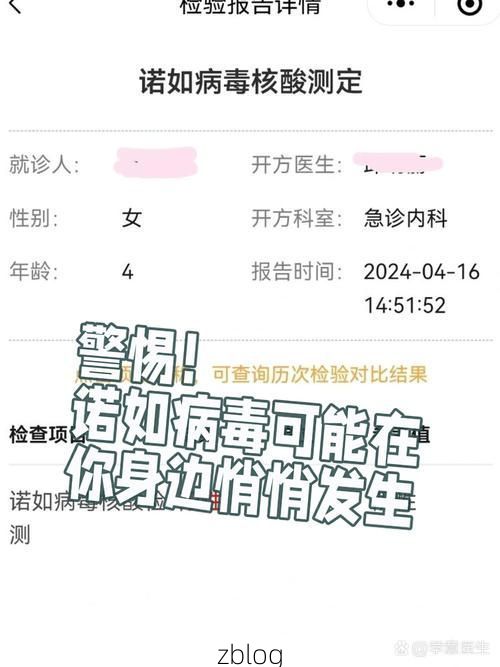 【绍兴县新增1例无症状感染者  绍兴县疫情防控最新通报_31924】