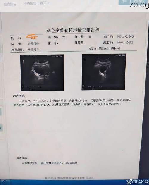 2022年7月19日玛曲县新增确诊病例情况_99699