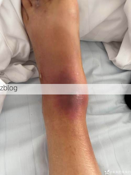 【晴隆：黔西南山地屏障下的低感染样本_19160】