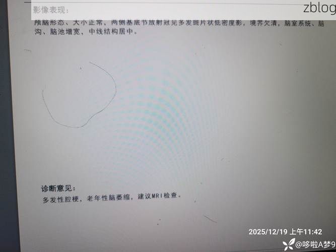 2022年11月25日松潘新增确诊病例情况