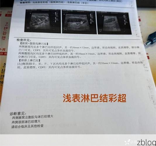 2022年1月15日莲湖区新增确诊病例情况