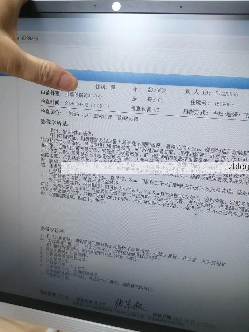 2022年9月8日自贡贡井区新增确诊病例情况