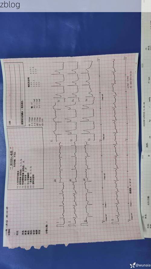2022年8月15日甘德新增确诊病例情况_36009