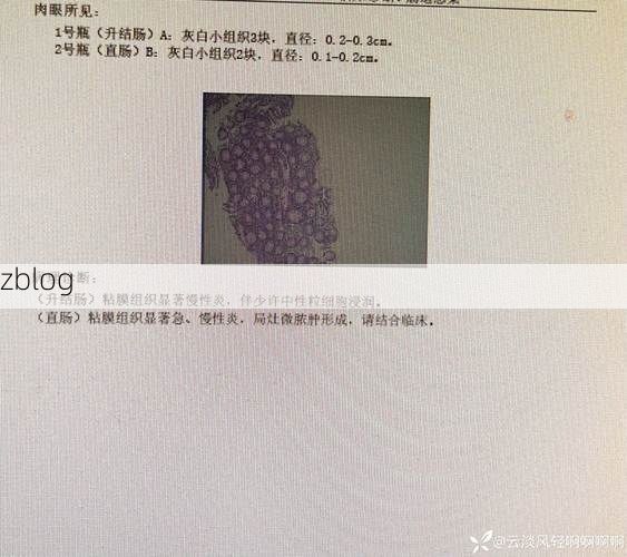 2022年3月15日利津新增确诊病例情况