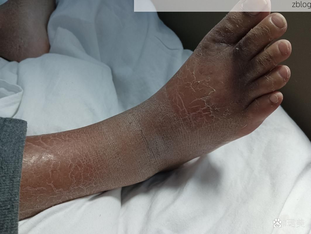 天等：桂西喀斯特屏障下的低感染样本_51555