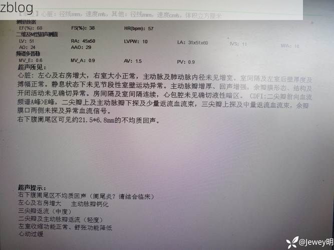 本地确诊+3，西乡县通报新增病例情况_63633