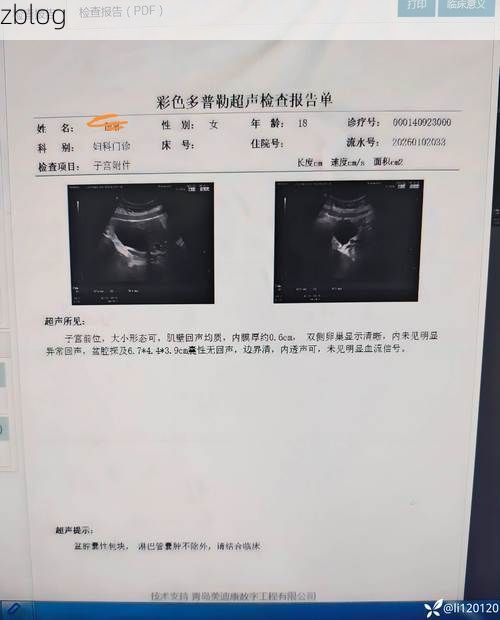 2022年9月20日纳雍县新增确诊病例情况_61062