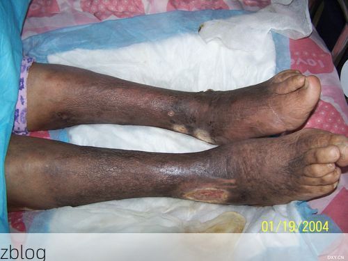 天等：桂西喀斯特屏障下的低感染样本_51603