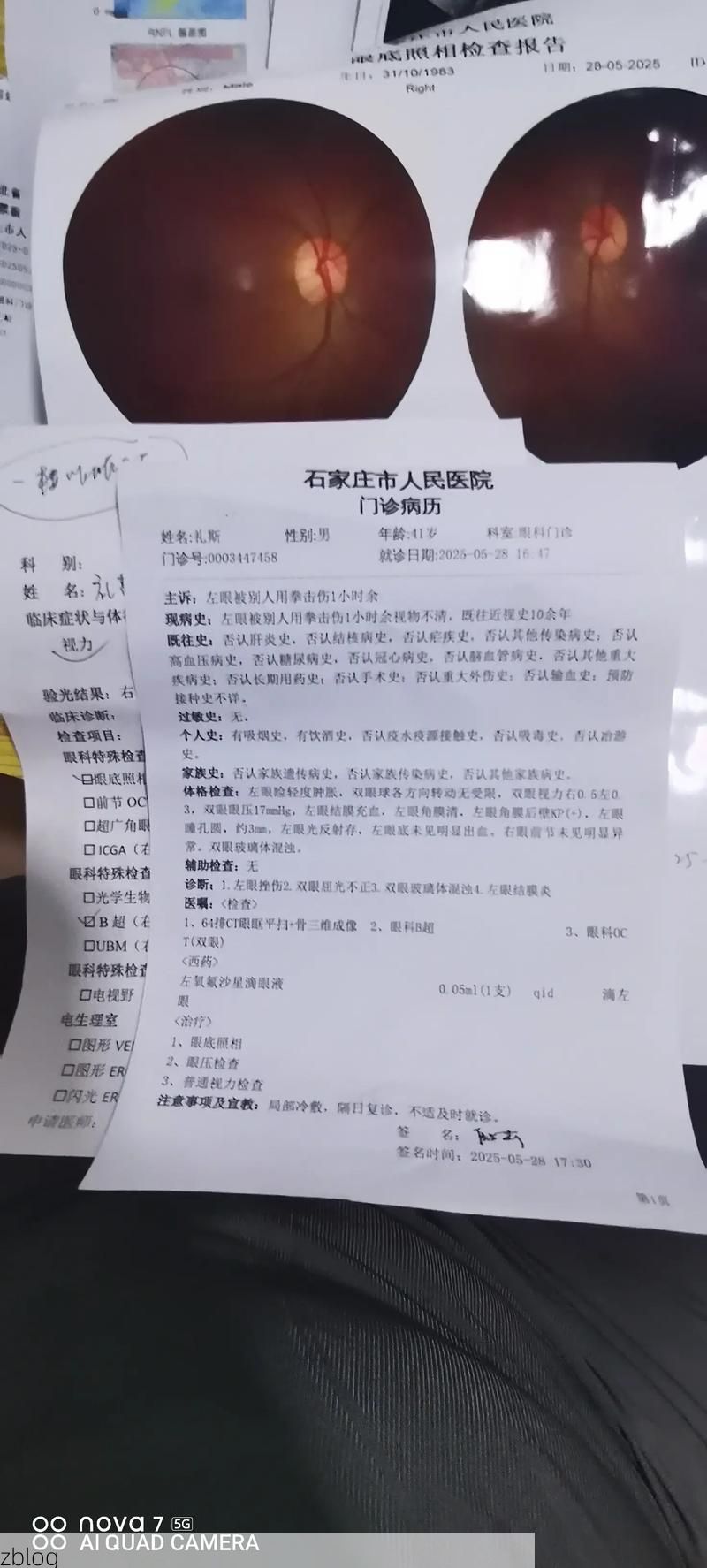 2022年8月15日阿里地区札达县新增确诊病例情况_51087